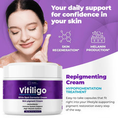 Aura Dermacare Vitiligo Cream tube on countertop showing easy daily use.
