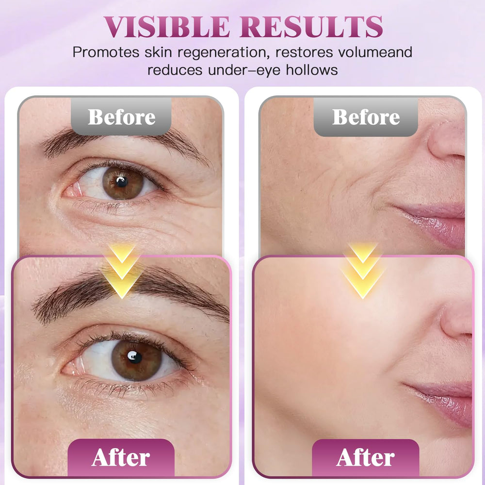 Auriela Calcium Volume Multi Balm on hand for precise, mess-free use.