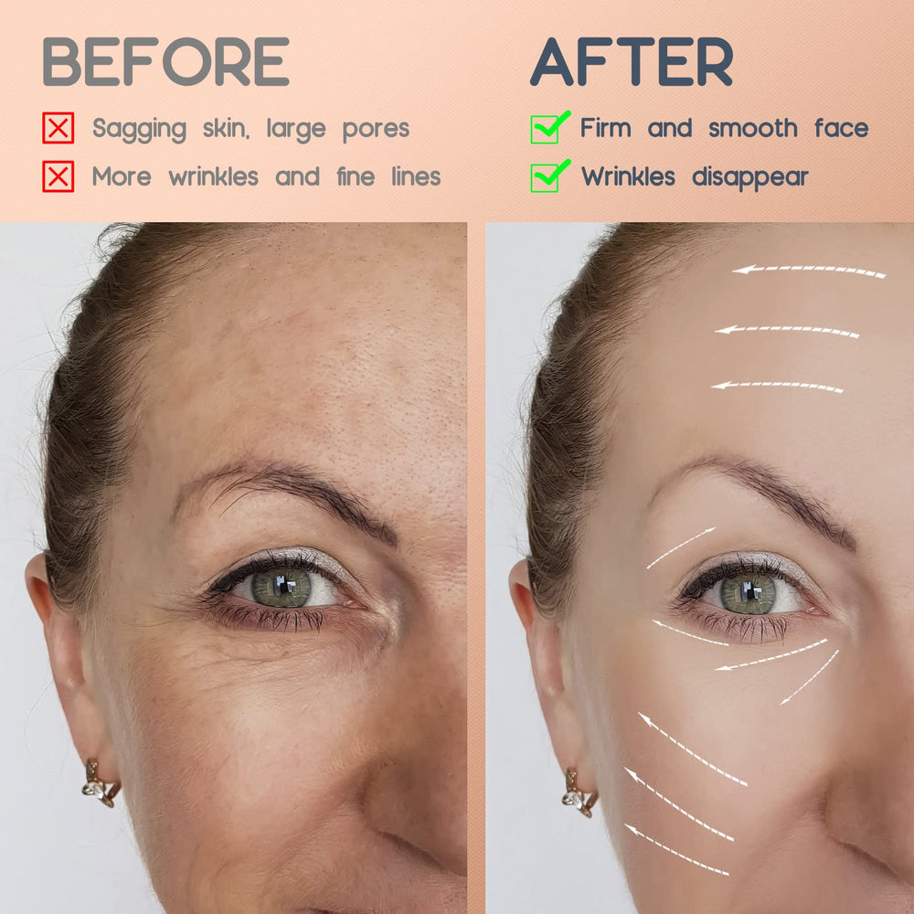 AURUZA neck-facial contour tightening supports gentle lift along jawline and neck area.