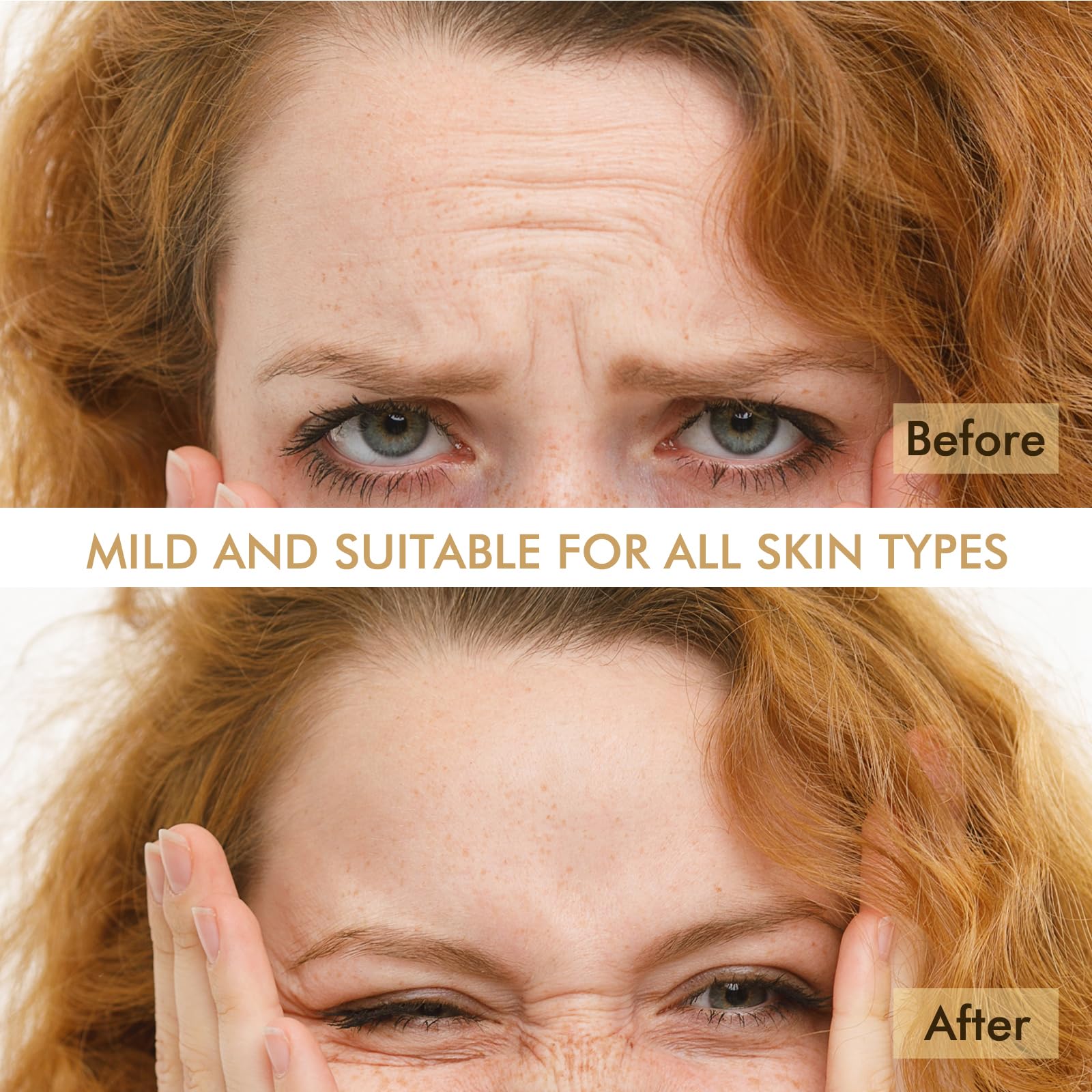 AUSLKA patches applied to the T zone for targeted forehead care.