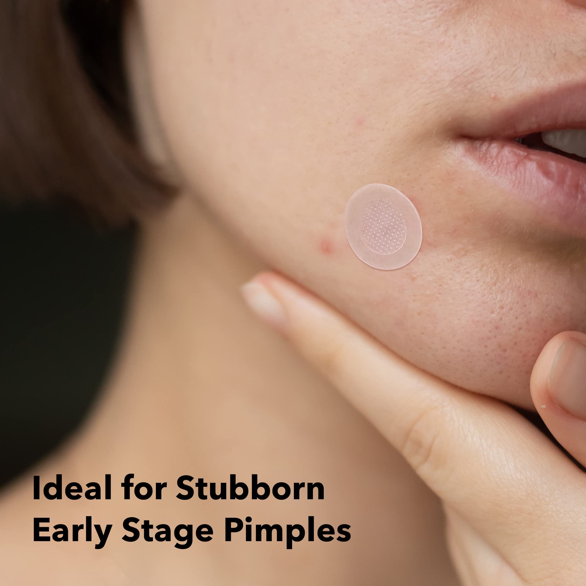 AVARELLE microneedle patch delivers formula through 80 cone-tip needles.