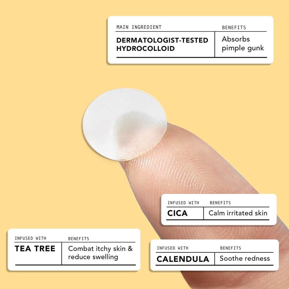 AVARELLE acne patches on face demonstrate universal fit and discreet daytime wear.