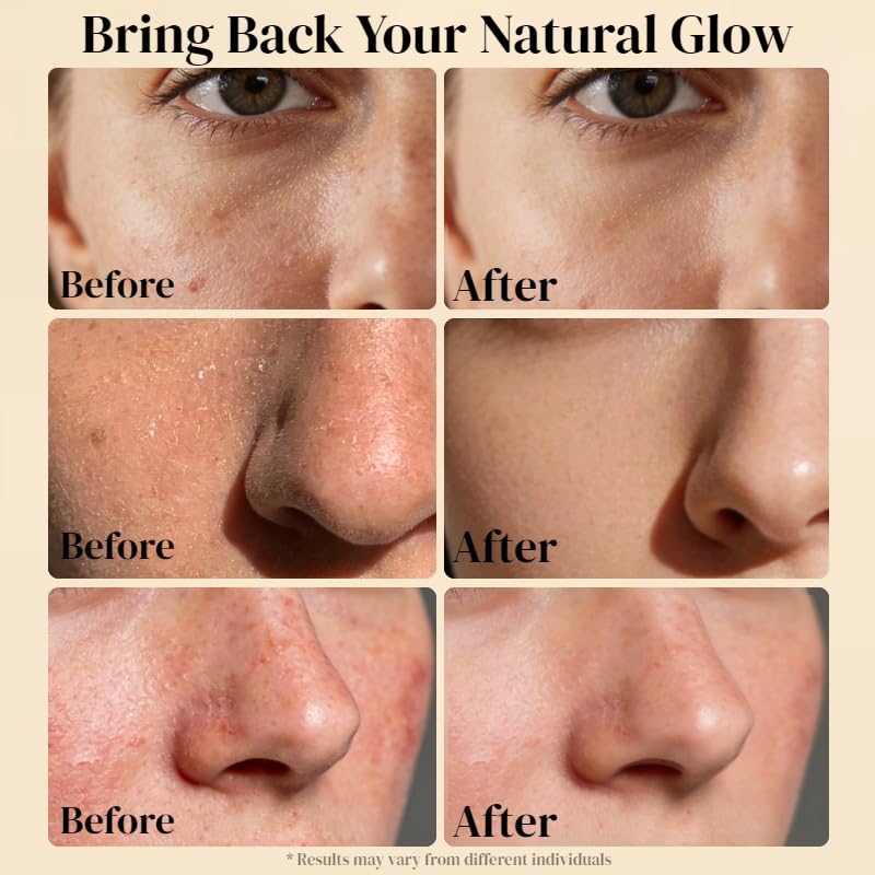 AveCera balm used under the eyes for gentle nourishment