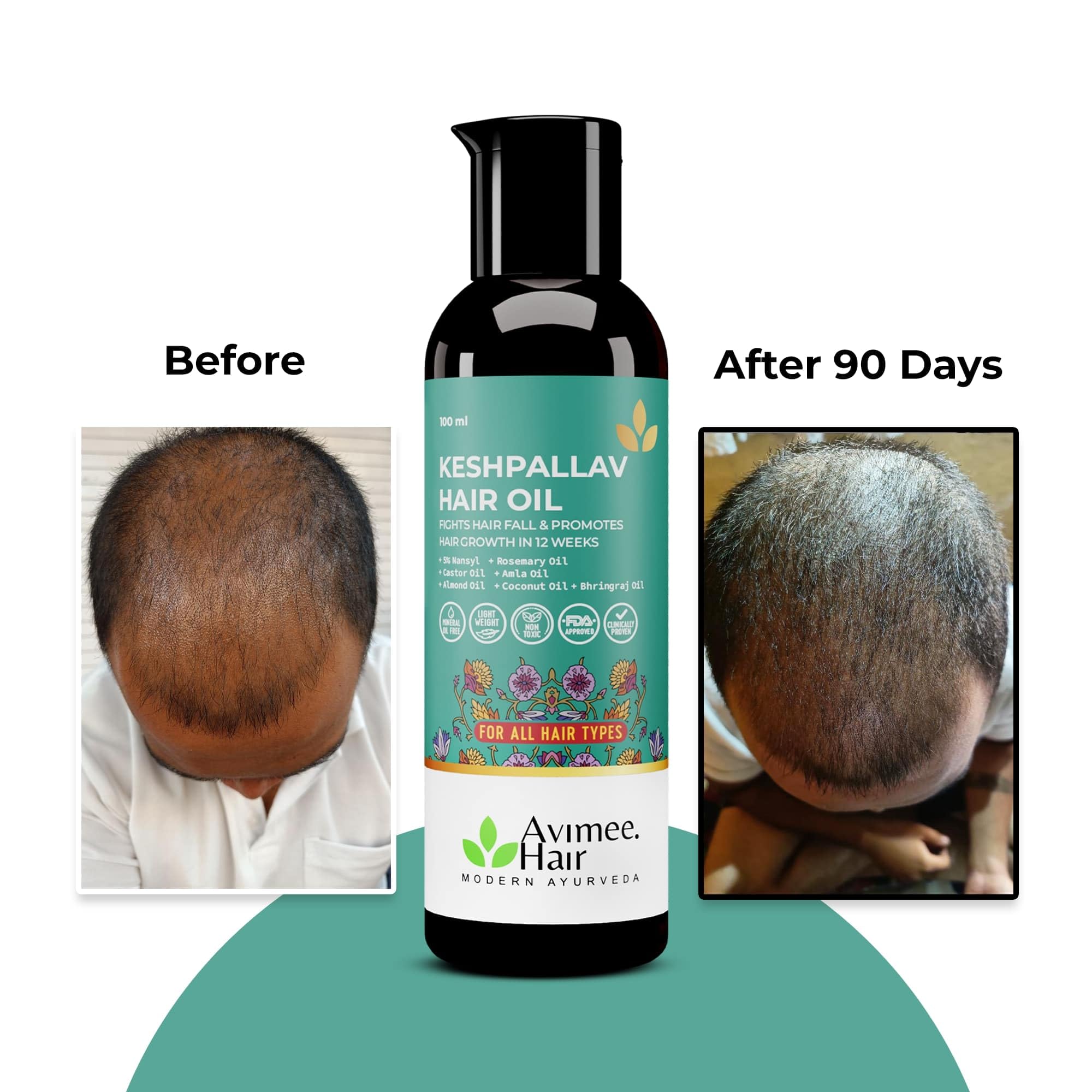 AVIMEE HERBAL Keshpallav Hair Oil featuring rosemary and castor for strengthened roots.
