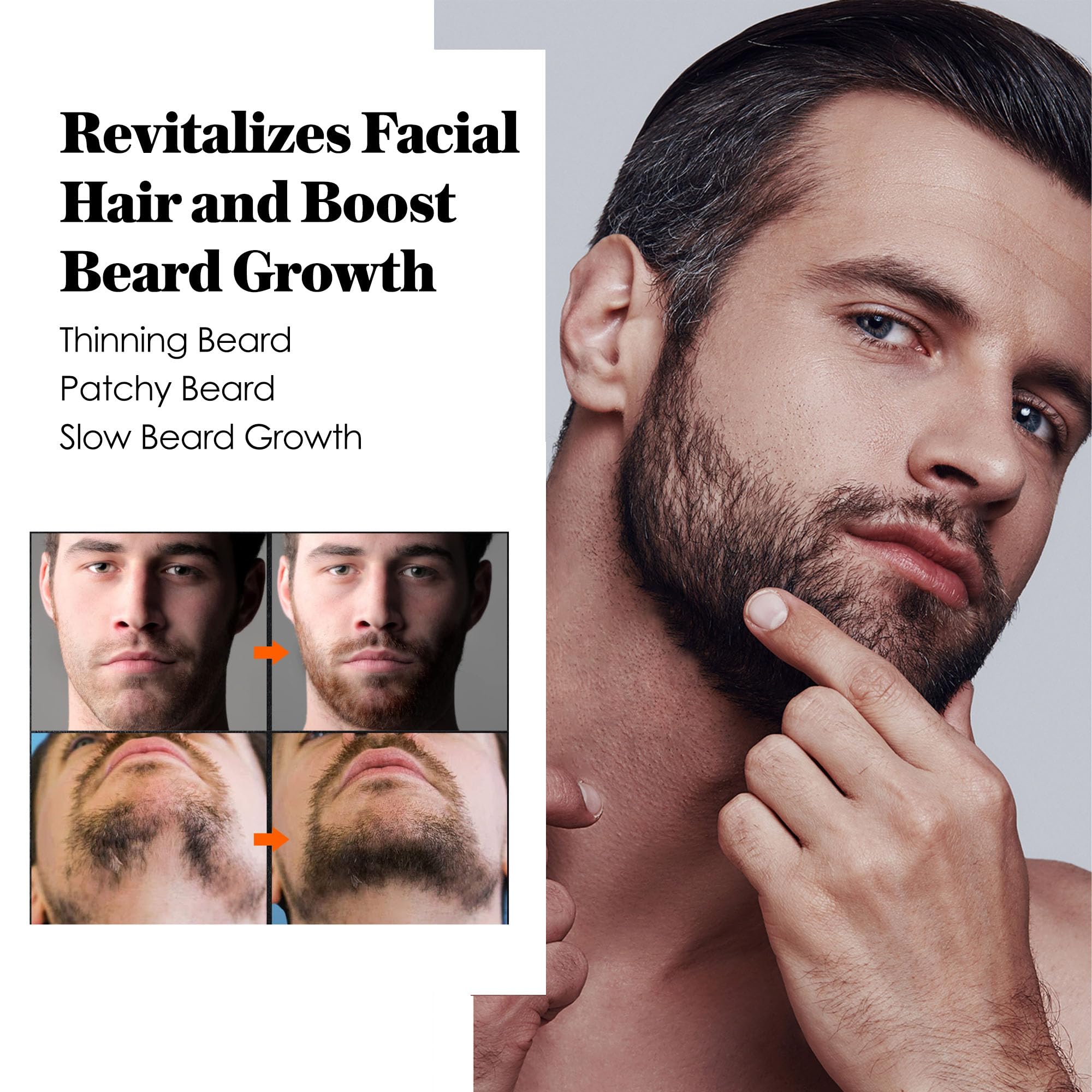 AVITAPURE Minoxidil beard oil dropper allows precise, comfortable dosing.
