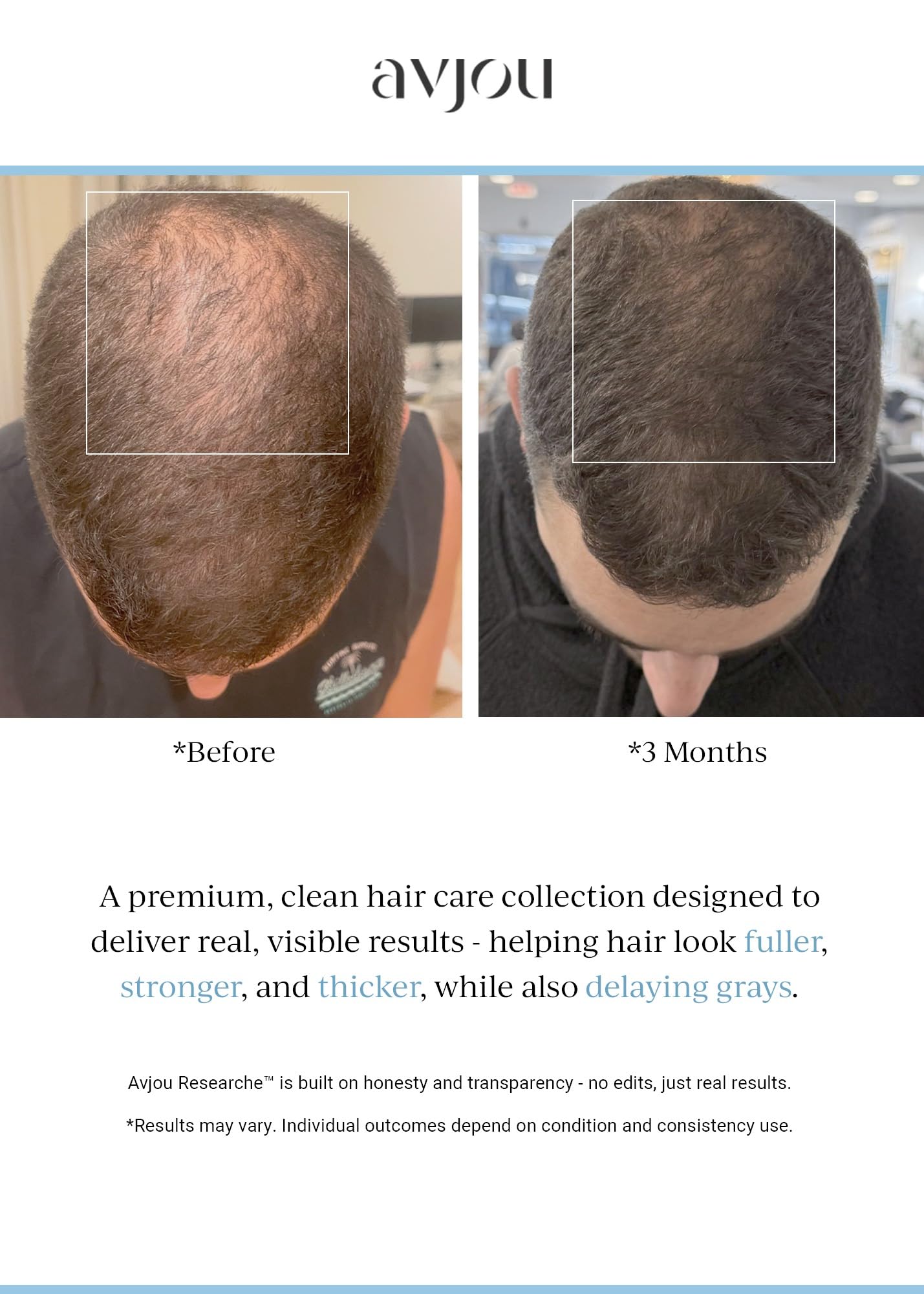 Avjou Researche scalp serum being massage-applied for even distribution
