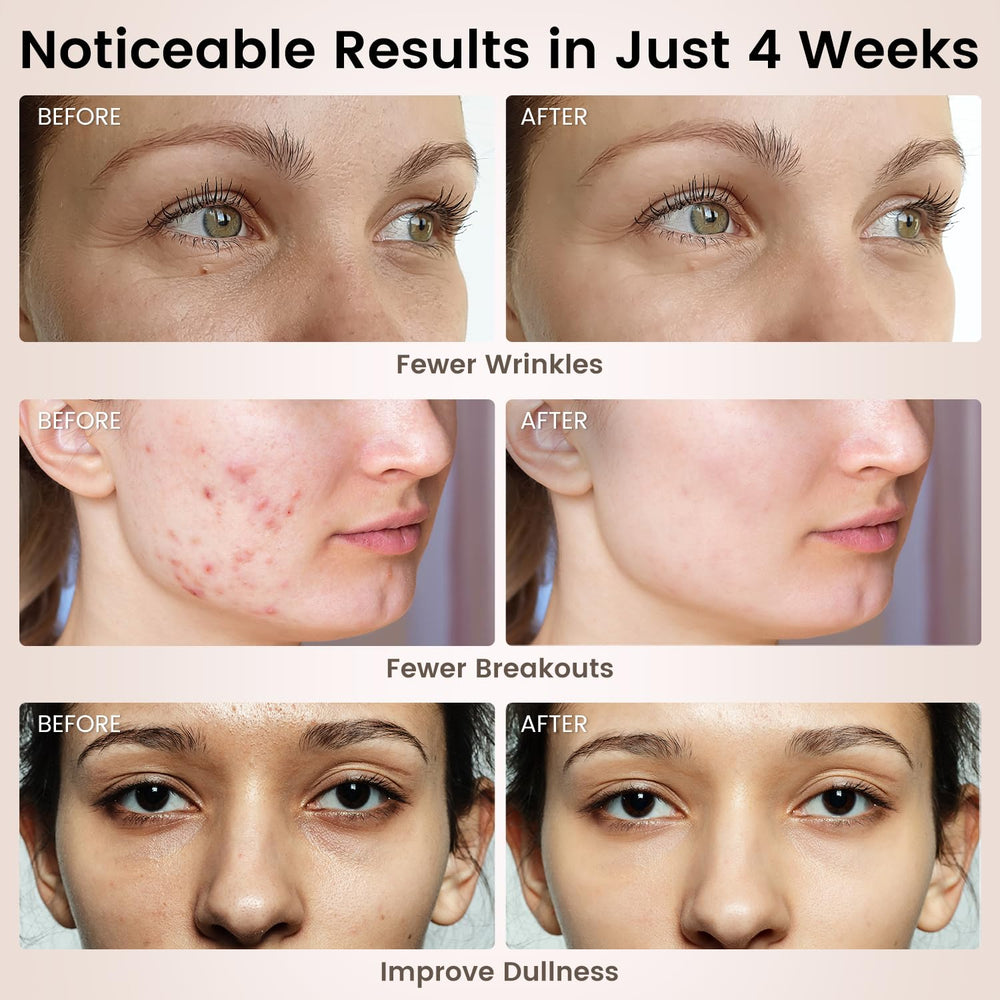 Avorla blue light mode for gentle blemish-focused sessions