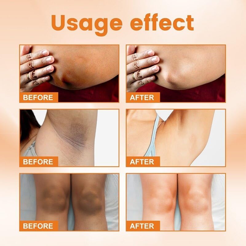 Axnoocy VVhitening Cream applied to private area