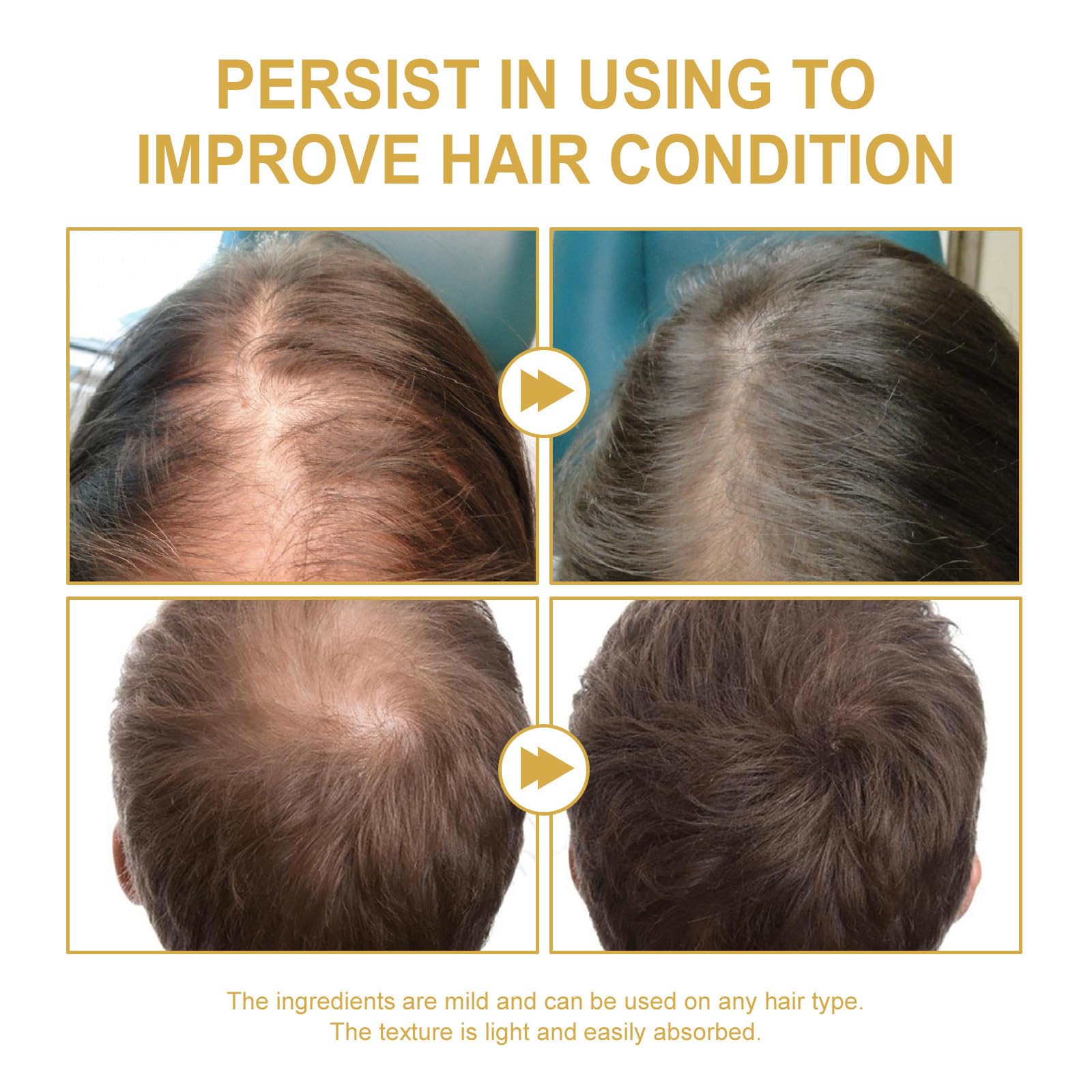 Axnzp Eelhoe rosemary oil on hair strands with healthy shine.