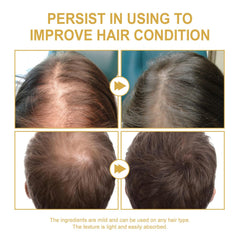 Axnzp Eelhoe rosemary oil on hair strands with healthy shine.