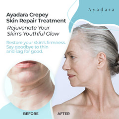 AYADARA Crepey Skin Repair Cream honey-shea infusion nourishes and hydrates skin.