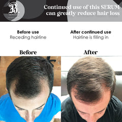 Hair after use shows enhanced shine and manageability with Biotin Treatment
