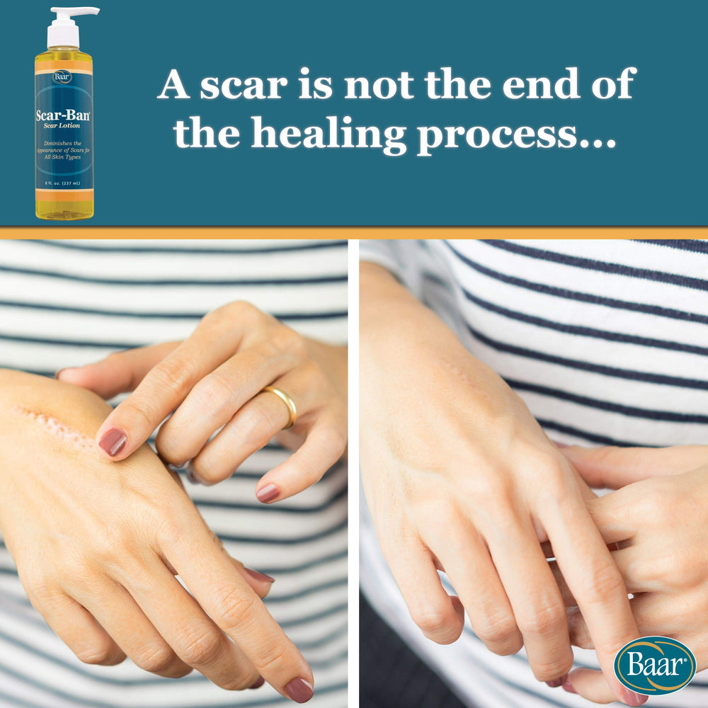 Baar Scar Ban label closeup showcases premium emollients for nourishing the skin.