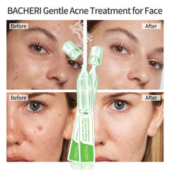 BACHERI daily ampoules pack highlights convenient 1.2 ml doses for fresh, mess-free application.