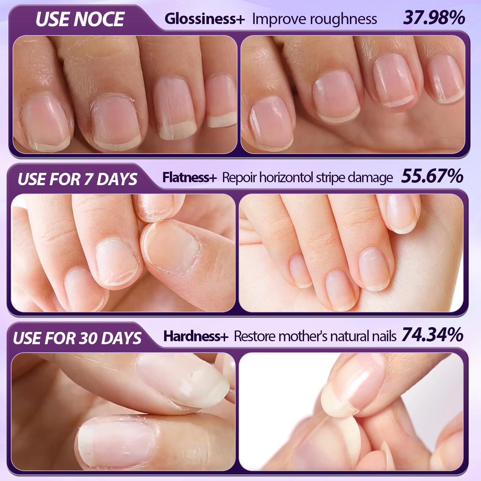 BaiKupo ceramic-tip remover enables precise, gentle cuticle care.