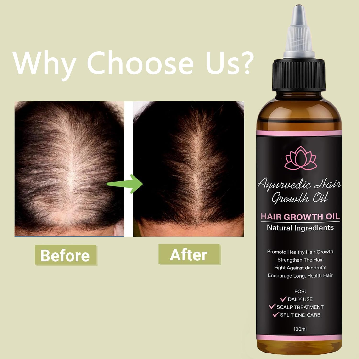 BALPPRD Lifewitqueenp oil dropper in use for gentle scalp application.