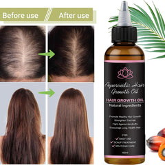 BALPPRD Lifewitqueenp packaging on display highlighting a lightweight Ayurvedic oil for daily care.