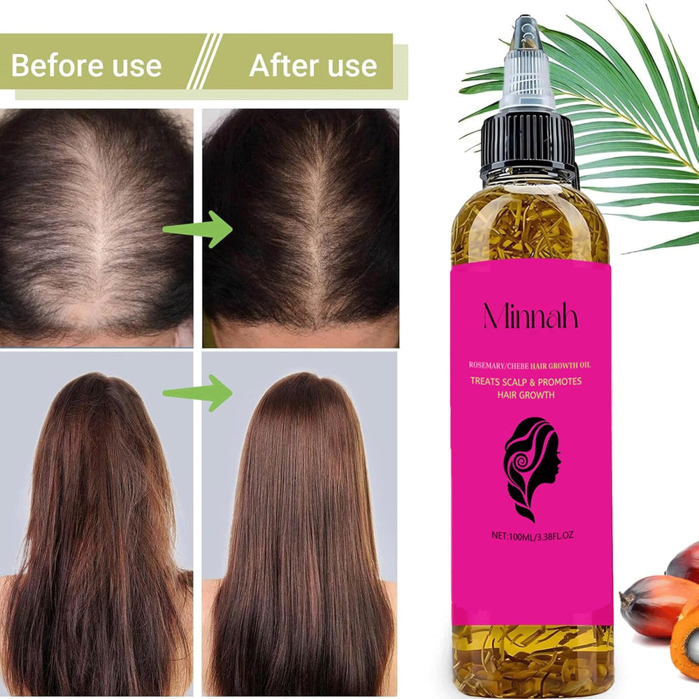 BALPPRD Minnah Batana Oil promotes hair growth potential.