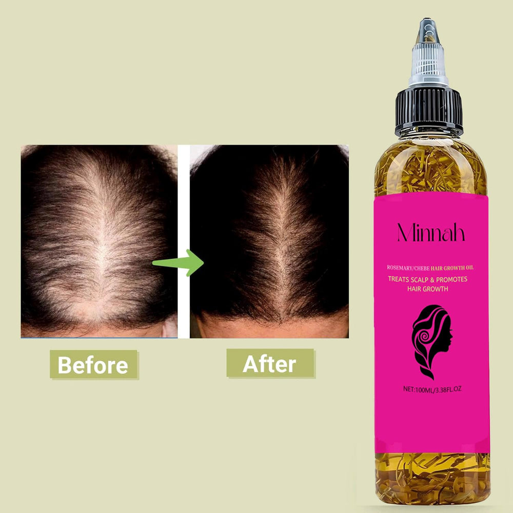 BALPPRD Minnah Batana Oil with rosemary suggests refreshing scent.