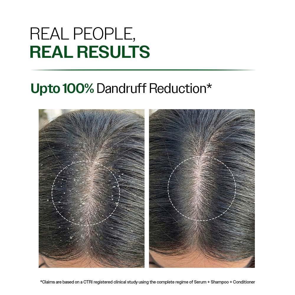 Dandruff flakes being washed away by Bare Anatomy Expert shampoo.