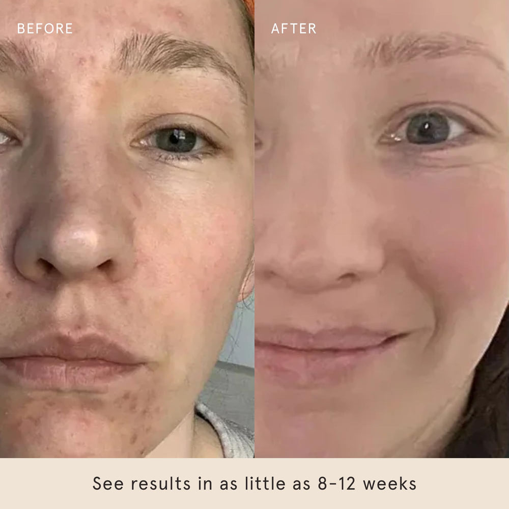 Barefaced Glow Peel Pads contain squalane and vitamin E to lock in moisture