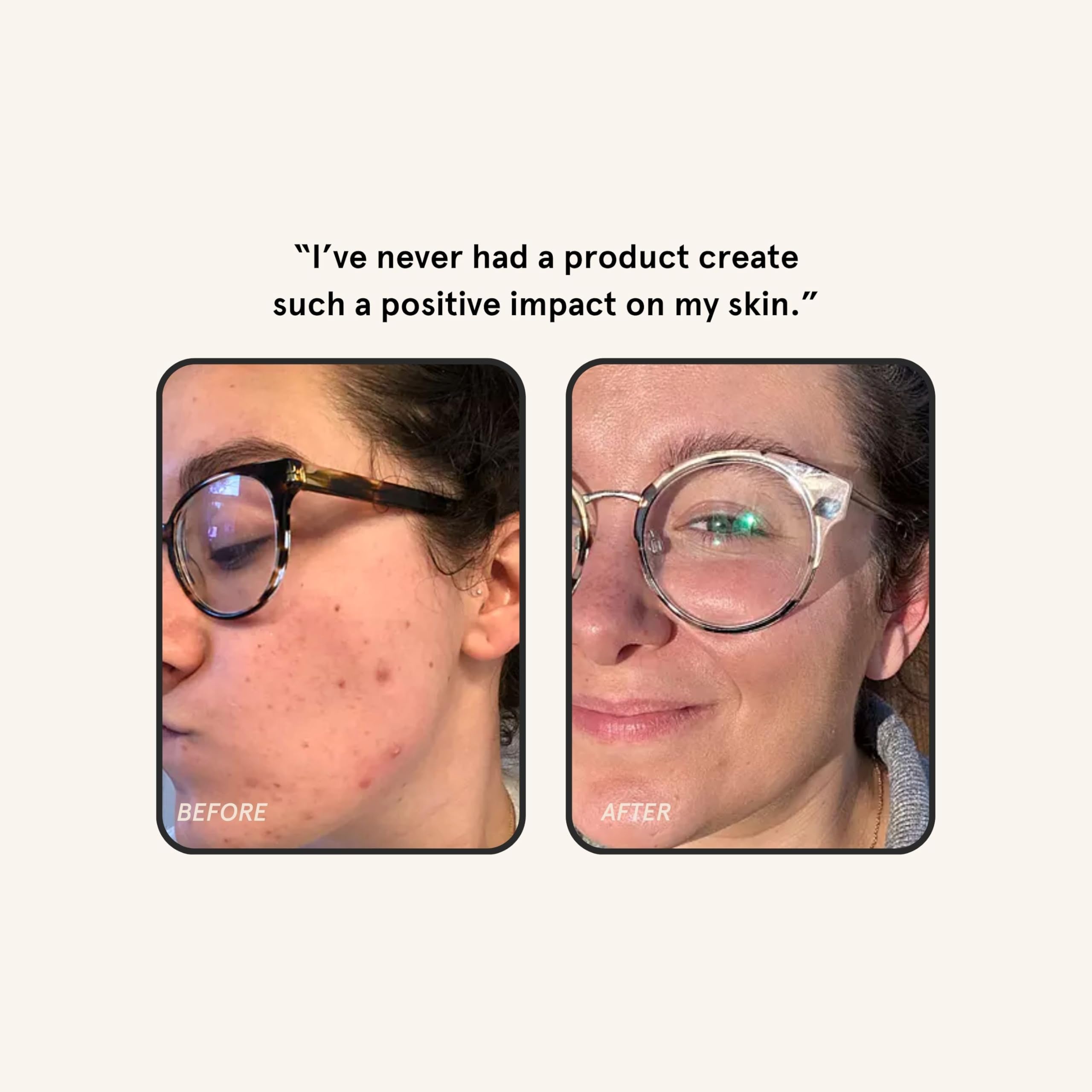 Barefaced Overachiever green tea icon emphasizes antioxidant support.