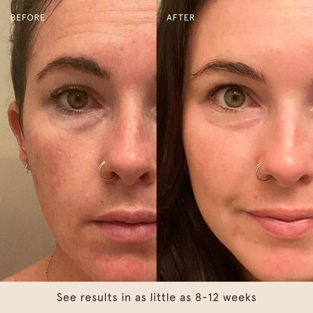 Barefaced Overachiever ingredients bakuchiol and resveratrol support gentle texture improvement.