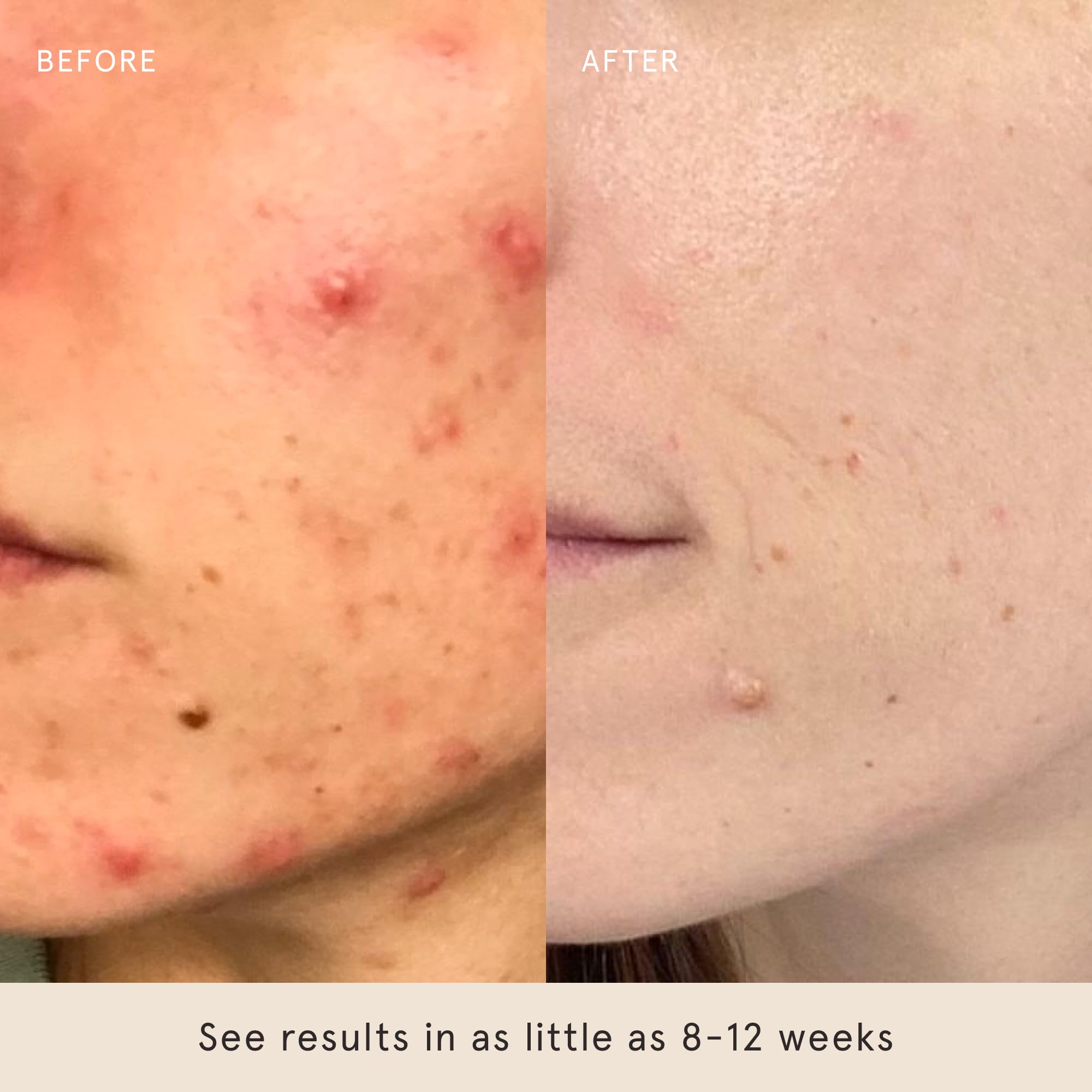 Barefaced Toning Pads II image focusing on pore refinement benefits.