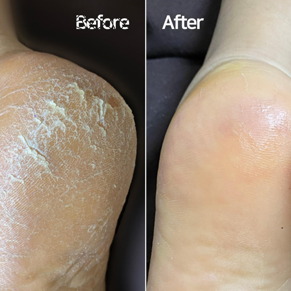 Baren Magic front-side file removes minor dead skin for gentle results.