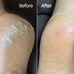 Baren Magic front-side file removes minor dead skin for gentle results.