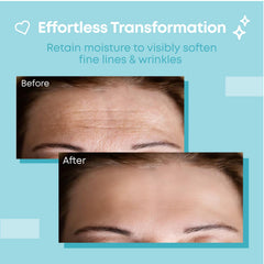 Bayside Forehead Wrinkle Patches closeup showing gentle reusable design