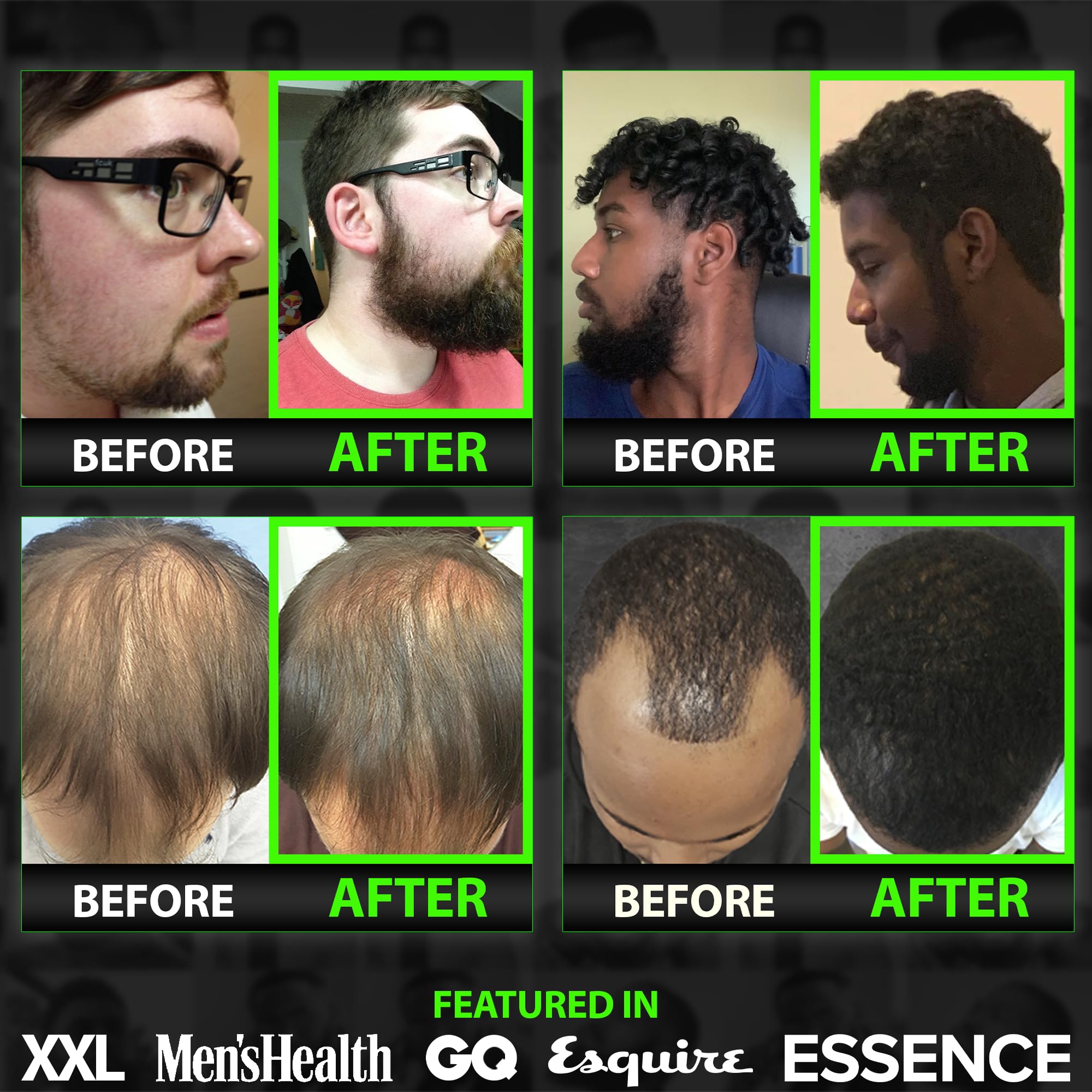 BBS Best Beard Stuff Beards care routine visual supports daily grooming