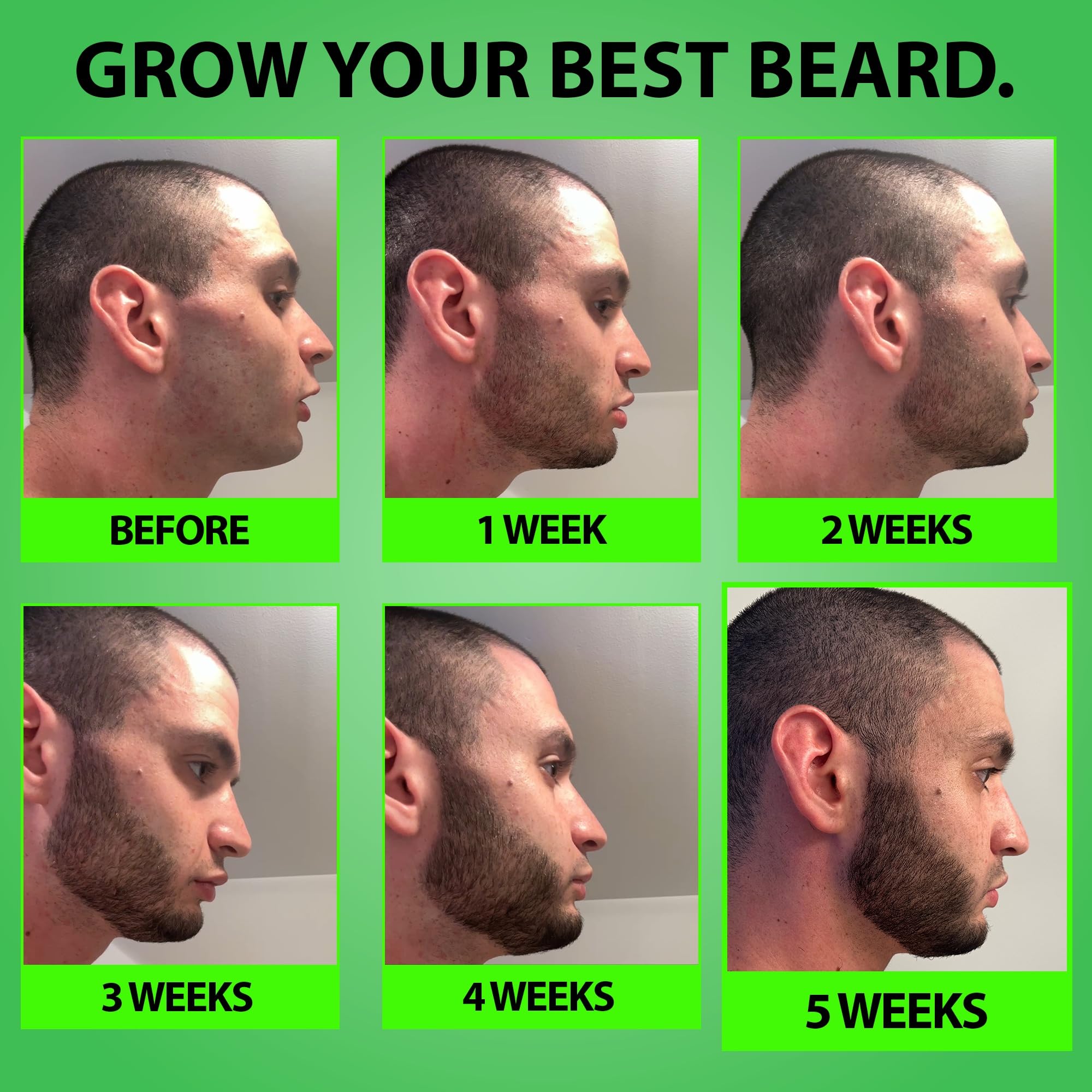 BBS Best Beard Stuff growth-support formula for patchy beards improves coverage