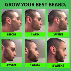 BBS Best Beard Stuff growth-support formula for patchy beards improves coverage
