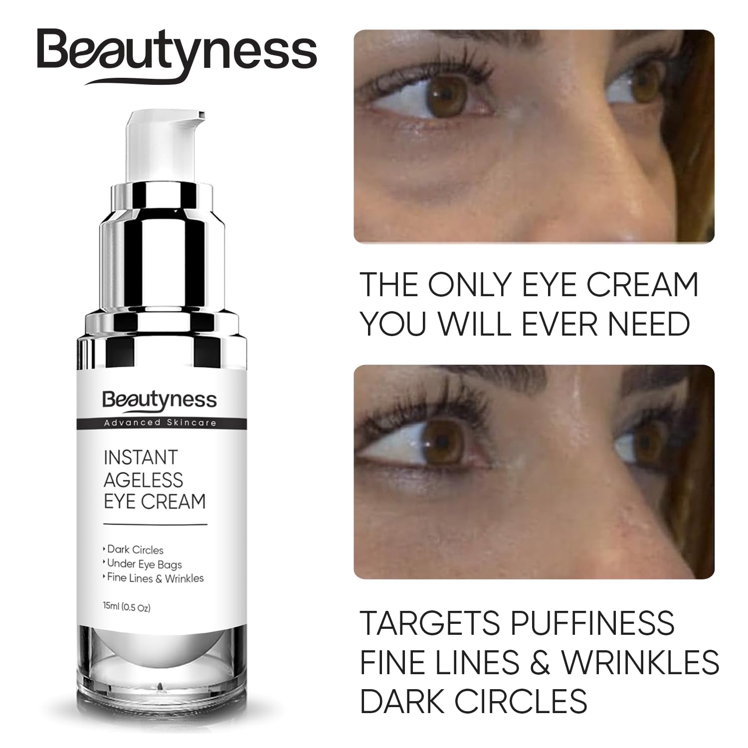 Beatool dark circles look diminished for a brighter eye contour.