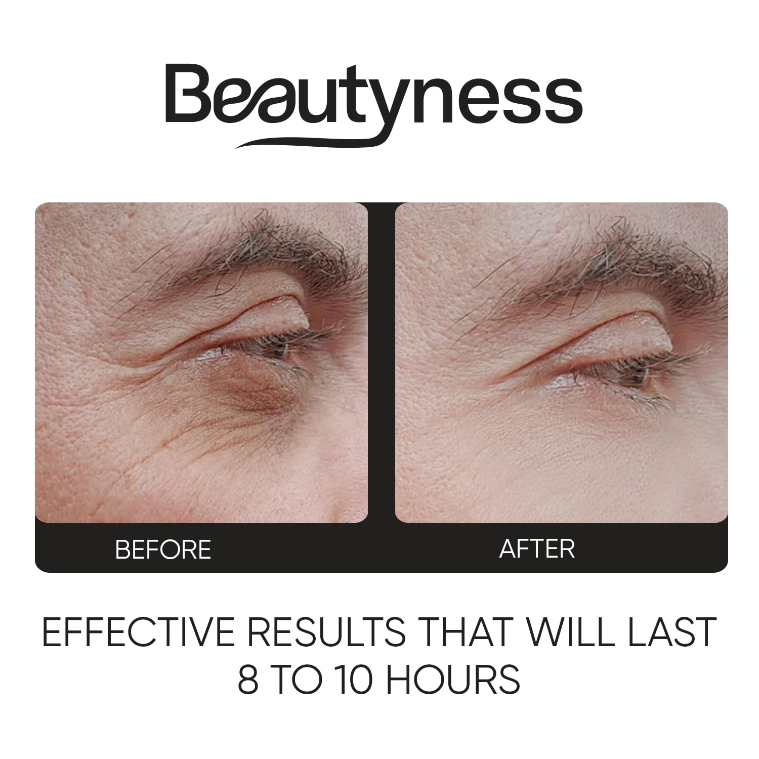 Beatool under-eye area lifted subtly, reducing puffiness.