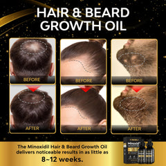 Beaueli minoxidil precision dropper enabling clean targeted application.