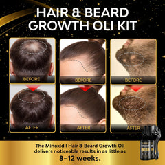 Beaueli beard growth kit packaging with clean, user friendly design