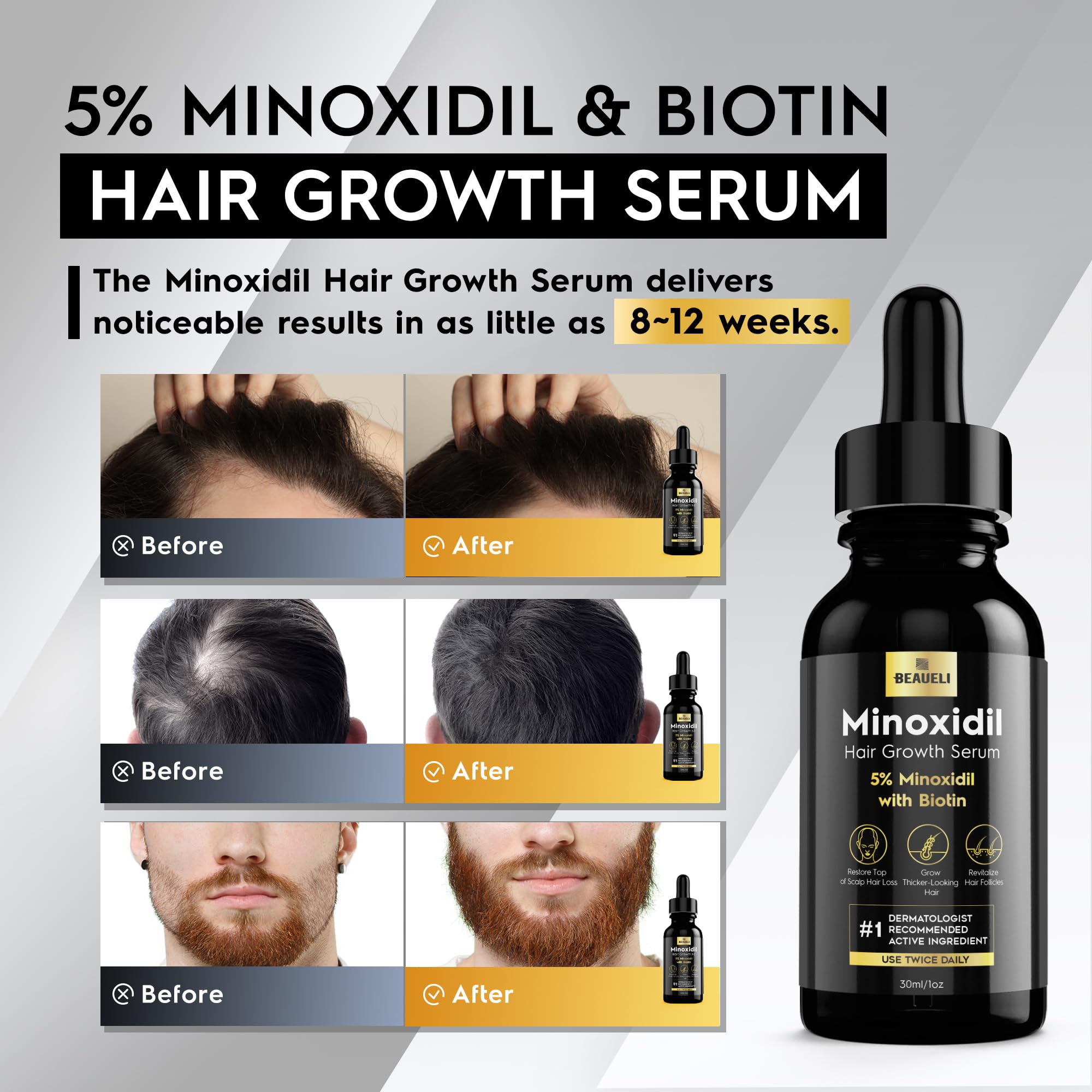Beaueli minoxidil serum dropper for precise application.