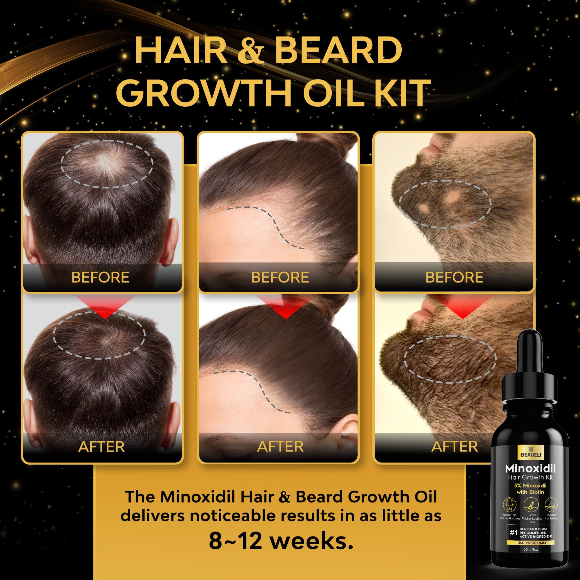 Beaueli Minoxidil women's hair growth serum demonstrating thinning hair support