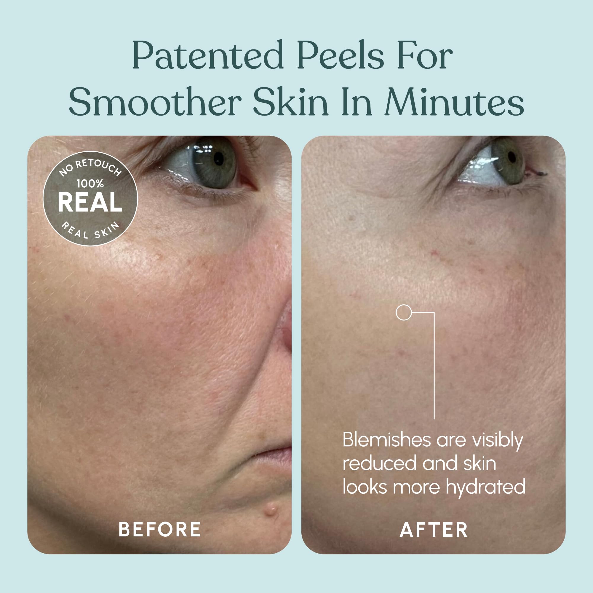 Beautiste four-week brightening progress image hints at dramatic results.