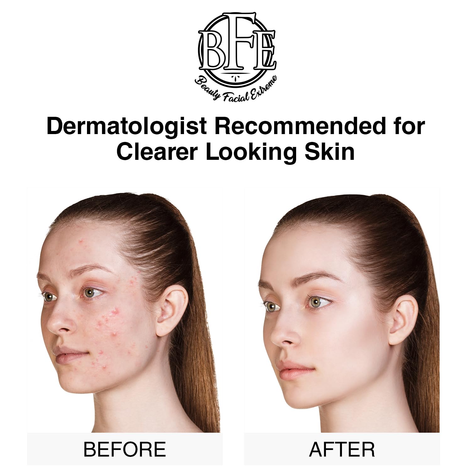 Close-up texture of Beauty Facial Extreme Acne Pads for exfoliation.