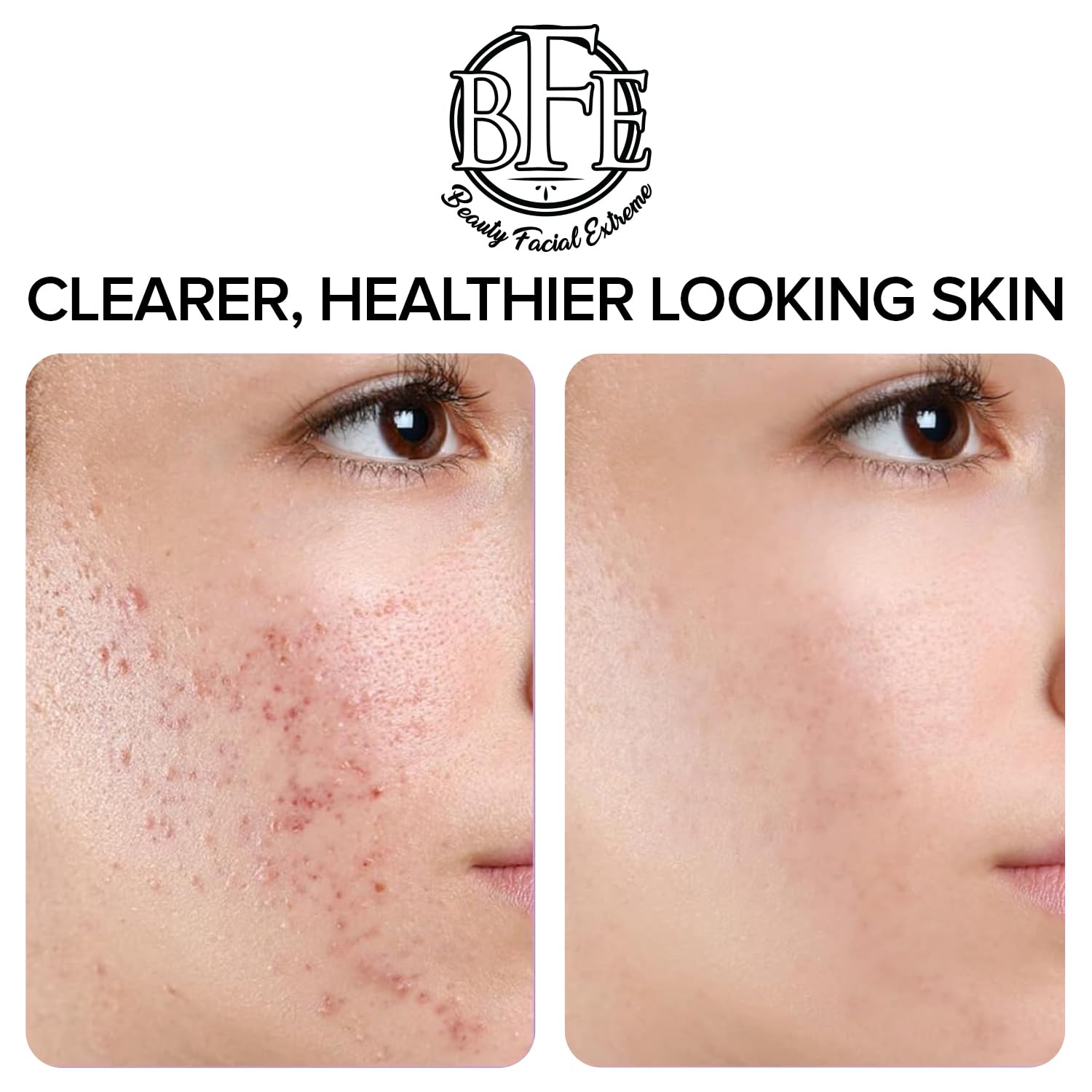 Pad included in a night routine to help manage breakouts.