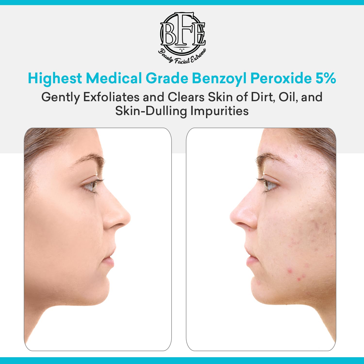 Beauty Facial Extreme wash suitable for face and body to target blemishes