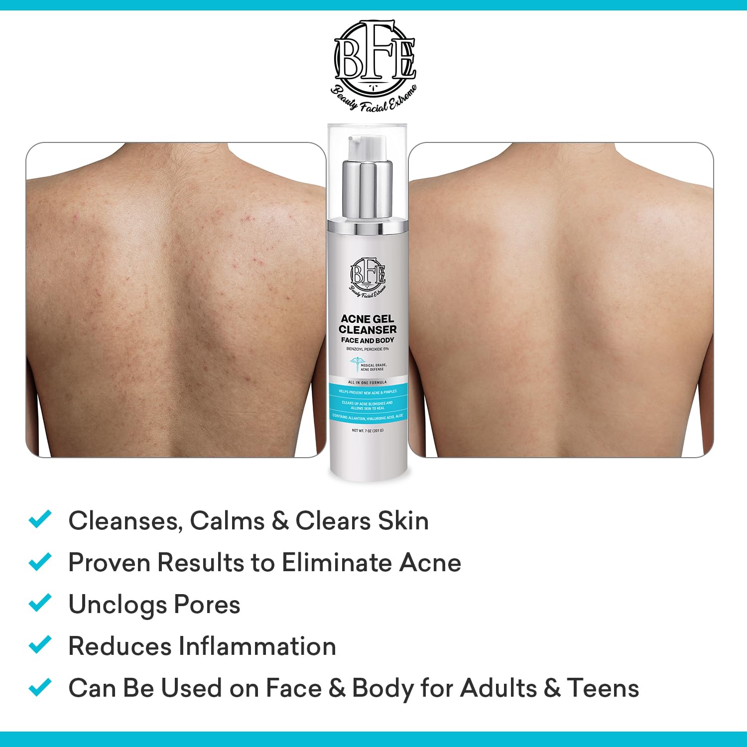 Beauty Facial Extreme wash packaging box highlighting ingredients and benefits