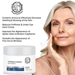Beauty Facial Extreme Vitamin K Cream bruising fade visual suggests improved marks.