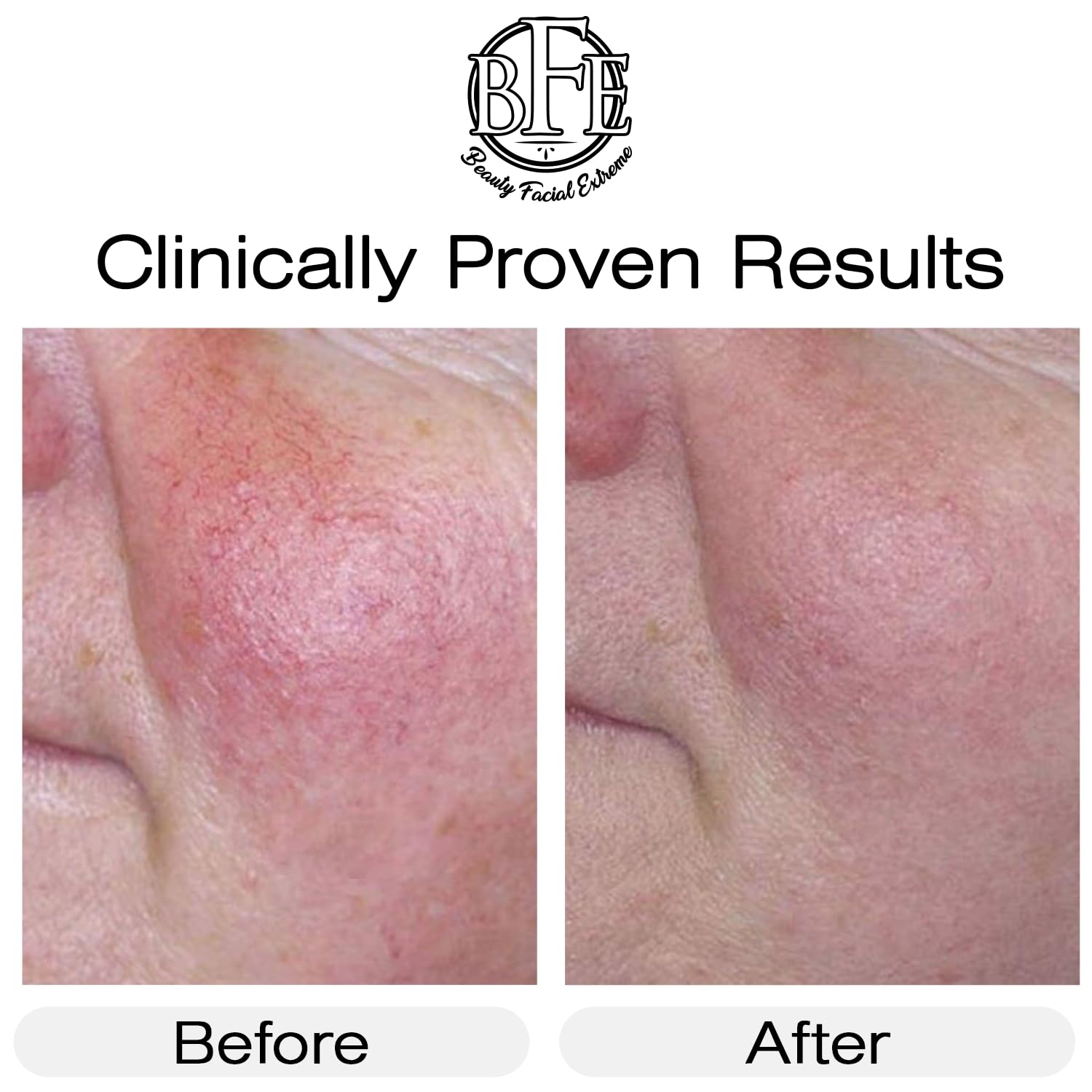 Beauty Facial Extreme Vitamin K Cream dermatologist-tested seal on packaging.