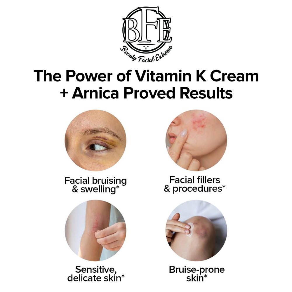Beauty Facial Extreme Vitamin K Cream spider veins image highlights reduced visibility.
