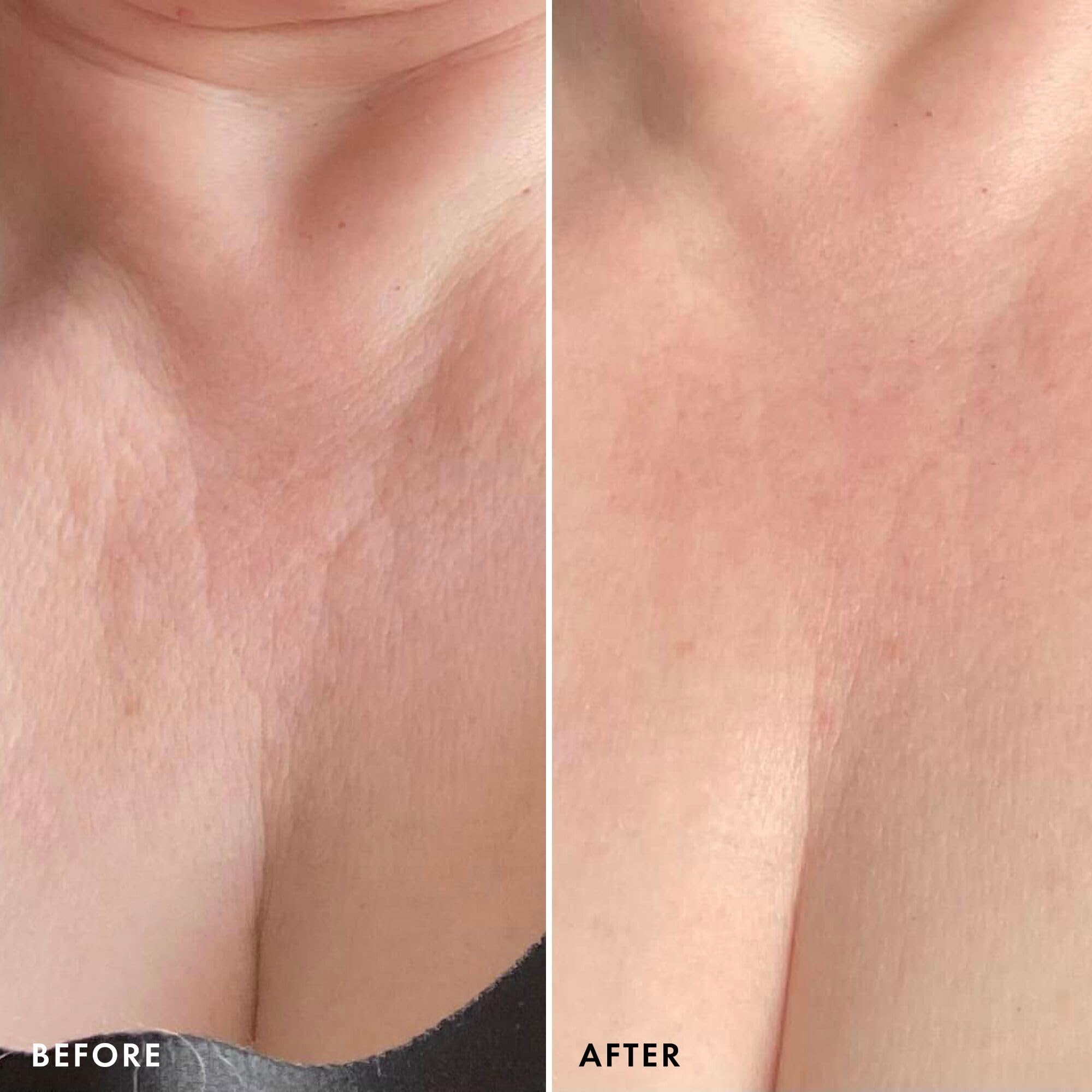 Beauty Pie Ueber Youth Niacinamide 5% brightens tone and supports the skin barrier.