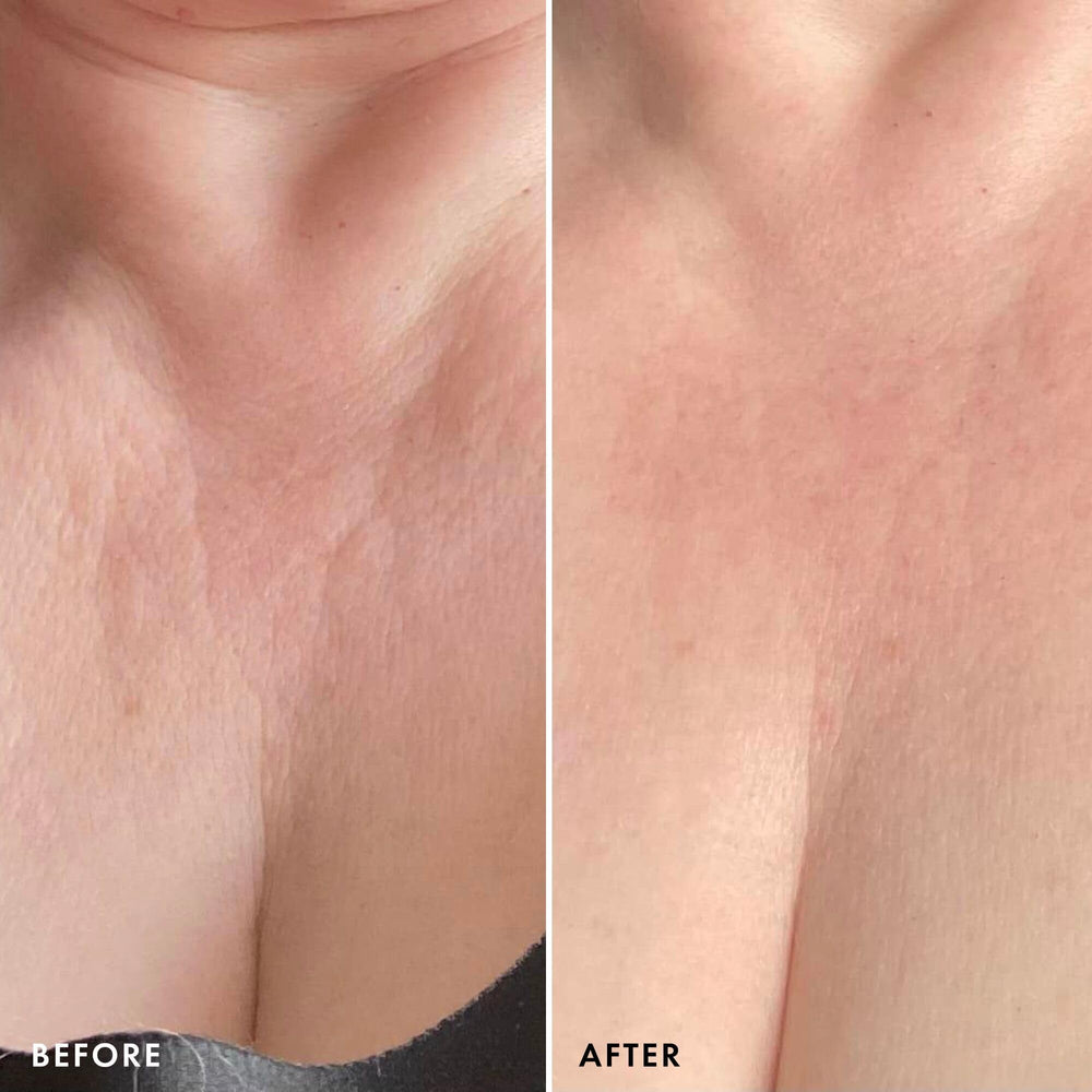 Beauty Pie Ueber Youth Niacinamide 5% brightens tone and supports the skin barrier.